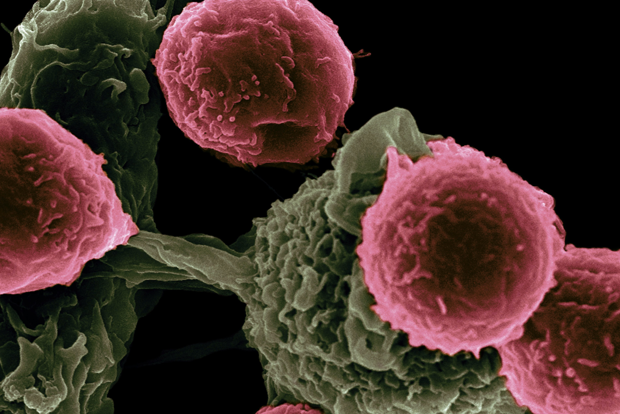 可侦测癌细胞生长的智能胸罩——是跟风还是科学？